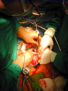 open-surgery-photo